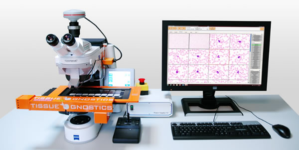 Система автоматического анализа мазков крови HemoFAXS производства TissueGnostics (Австрия)